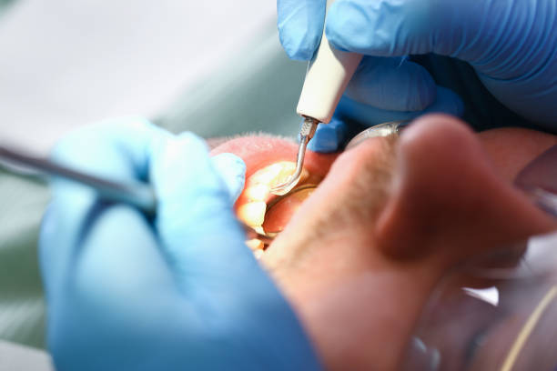 Best Emergency Treatment for Jaw Pain or Injury in La Junta, CO